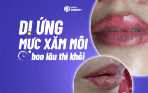 Dị Ứng Mực Xăm Môi Là Gì?