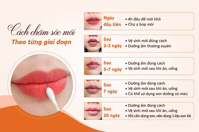 Quy Trình Chăm Sóc Môi Chuẩn Y Khoa
