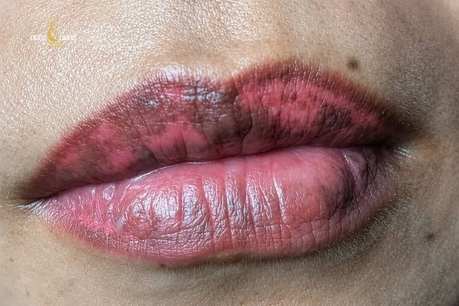 Cách Xử Lý Môi Bị Loang Màu An Toàn Và Hiệu Quả