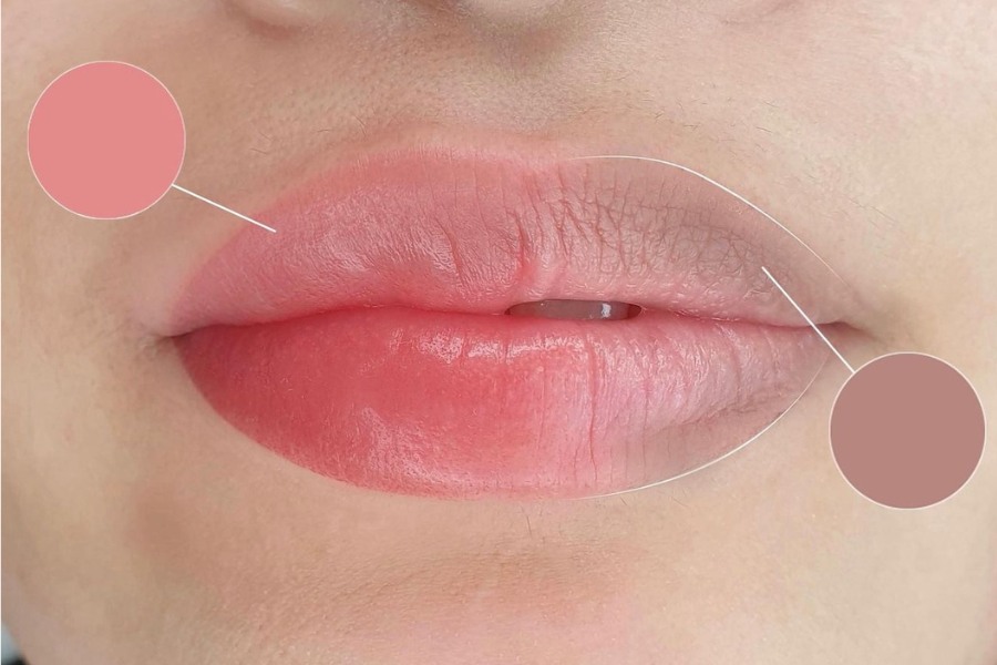 Hiệu Quả Thực Tế Và Độ Bền Sau Khi Khử Thâm
