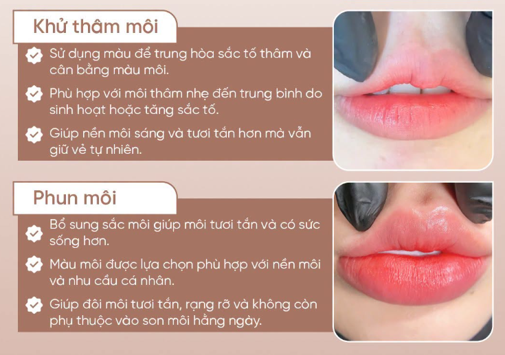 Các Giải Pháp Cải Thiện Màu Môi Thâm
