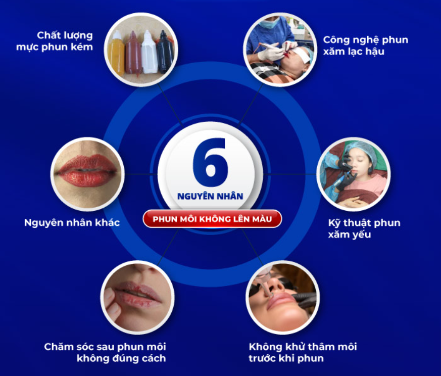 Top 5 Nguyên Nhân Khiến Phun Môi Không Lên Màu