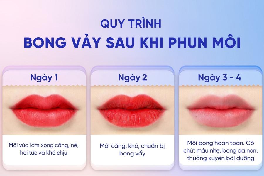 Quy trình bong mỗi