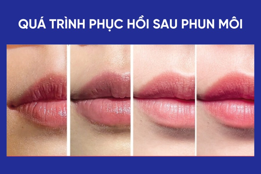 Phun Xăm Bao Lâu Thì Phục Hồi? Cách Chăm Sóc Môi Sau Phun