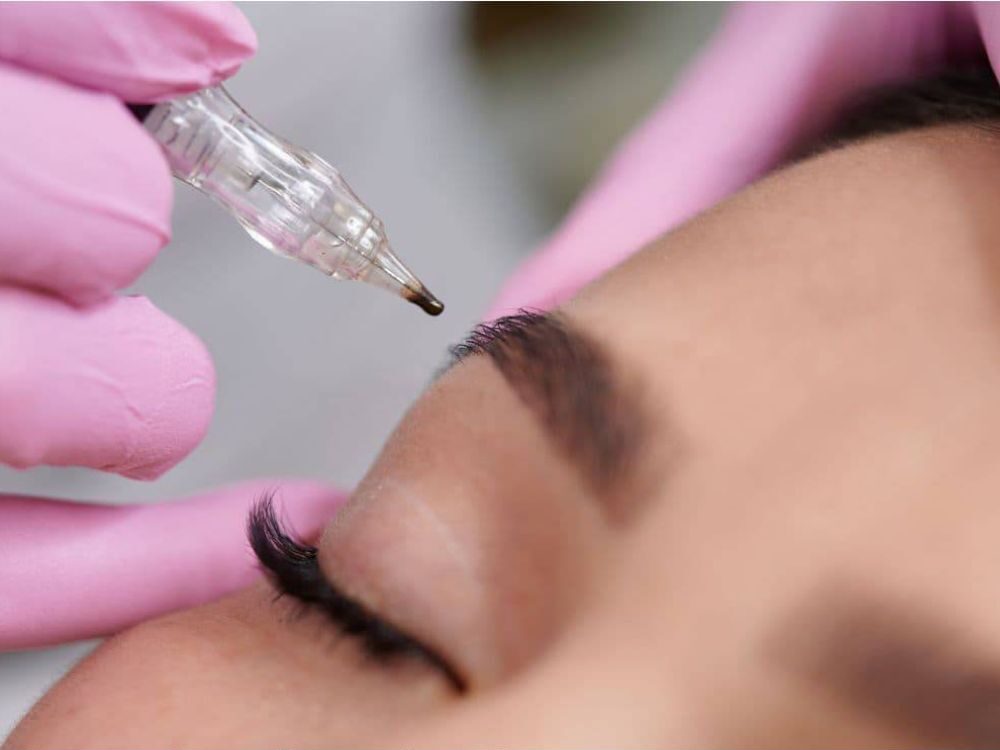 Các Trường Hợp Cần Đi Dặm Màu Ngay Khi Đủ Thời Gian
